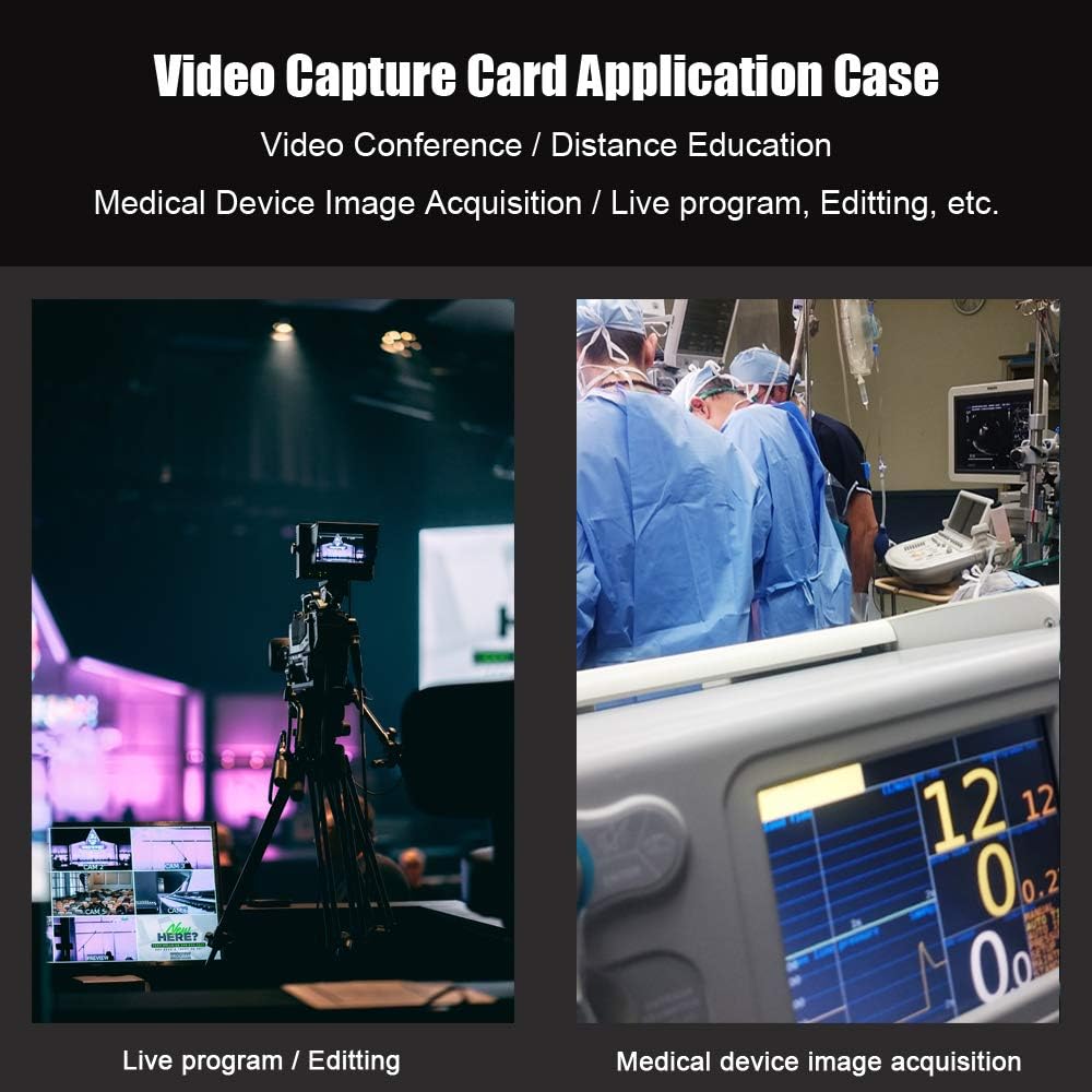 SDI to USB3.0 Video Capture 1080P 60fps Z2602